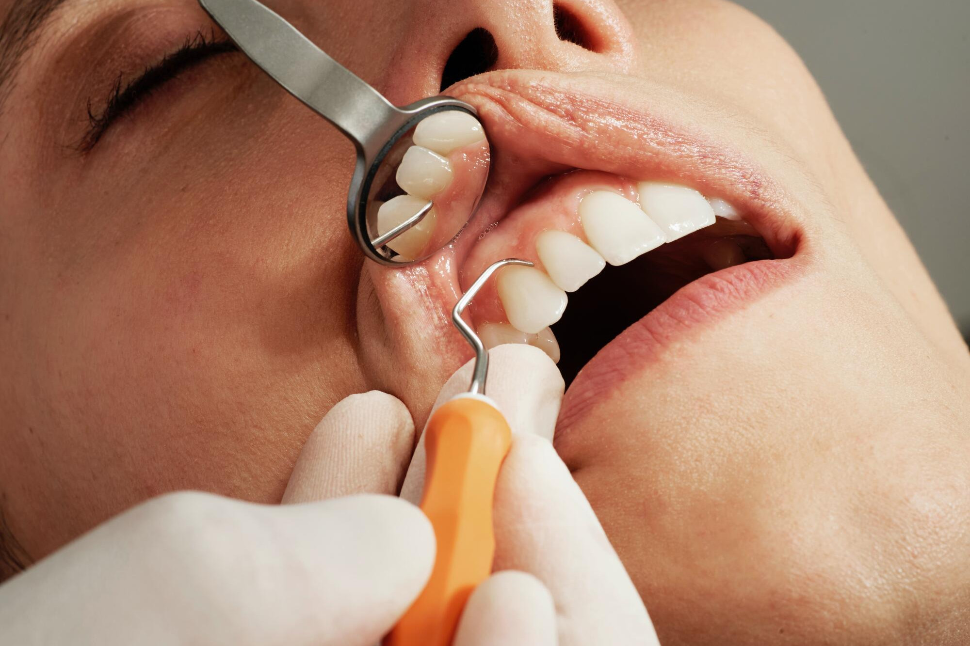 Dental care push - feature photo