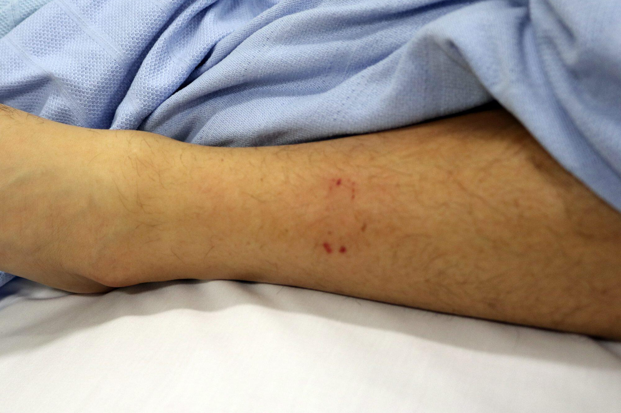 Snake bite warning from paramedics - feature photo